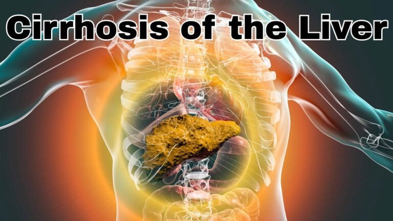 Cirrhosis of the Liver: Causes, Symptoms, and Treatment