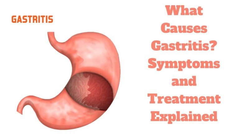 What Causes Gastritis Symptoms and Treatment Explained (2)